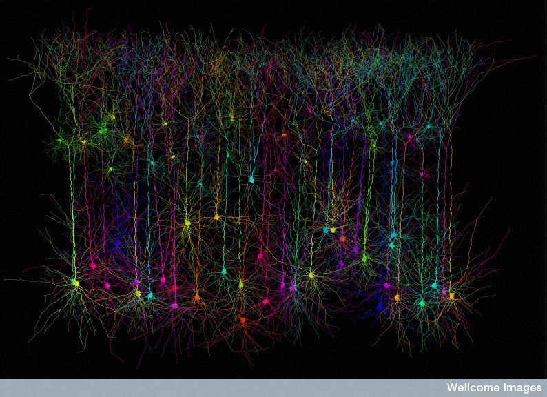 Image : Prof. M. Hausser / UCL / Wellcome Images/flickr