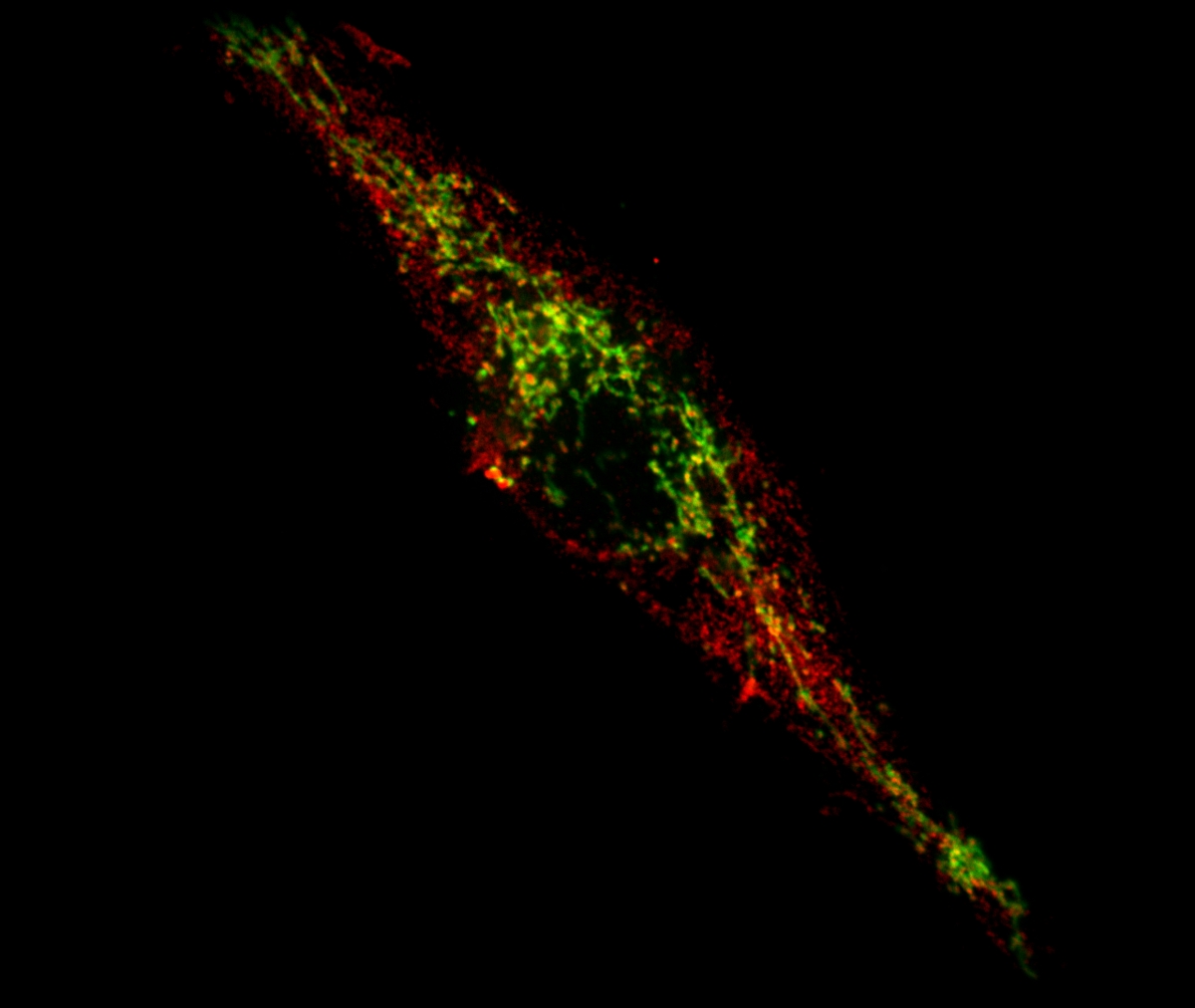 Une cellule où est absente la protéine PINK1 liée à la maladie de Parkinson s'apprête à présenter des antigènes mitochondriaux (en rouge) à sa surface pour allerter le système immunitaire. Les mitochondries intactes sont observées en vert.